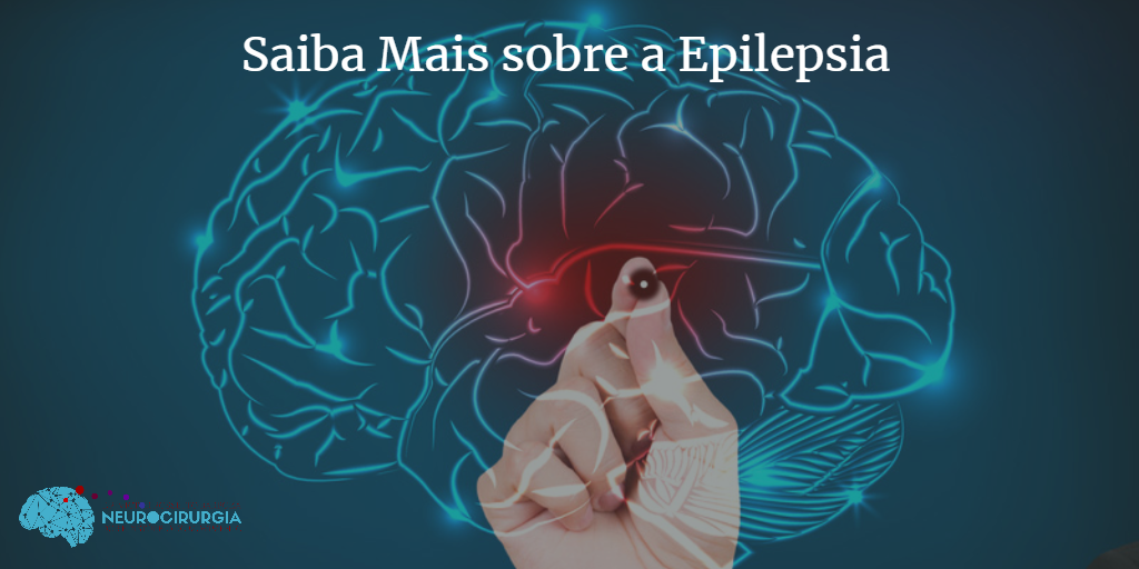 Saiba Mais Sobre A Epilepsia Dr Victor Batboza Neurocirurgia