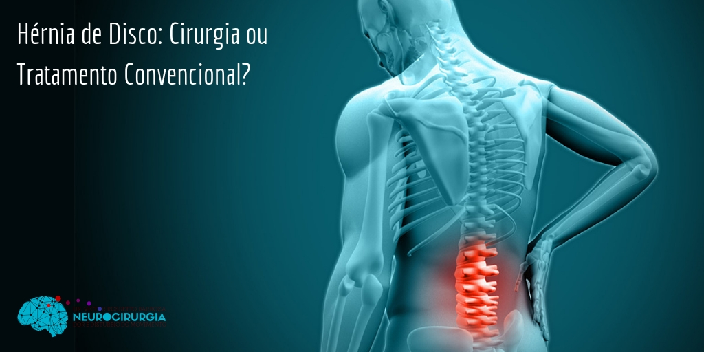 H Rnia De Disco Cirurgia Ou Tratamento Conservador