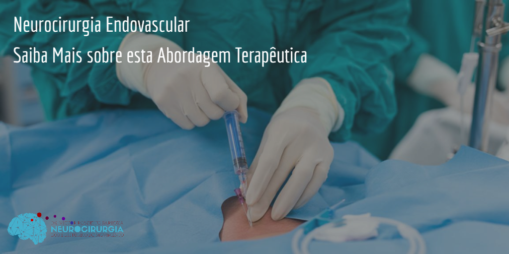 Neurocirurgia Endovascular Saiba Mais Sobre Esta Abordagem Terap Utica