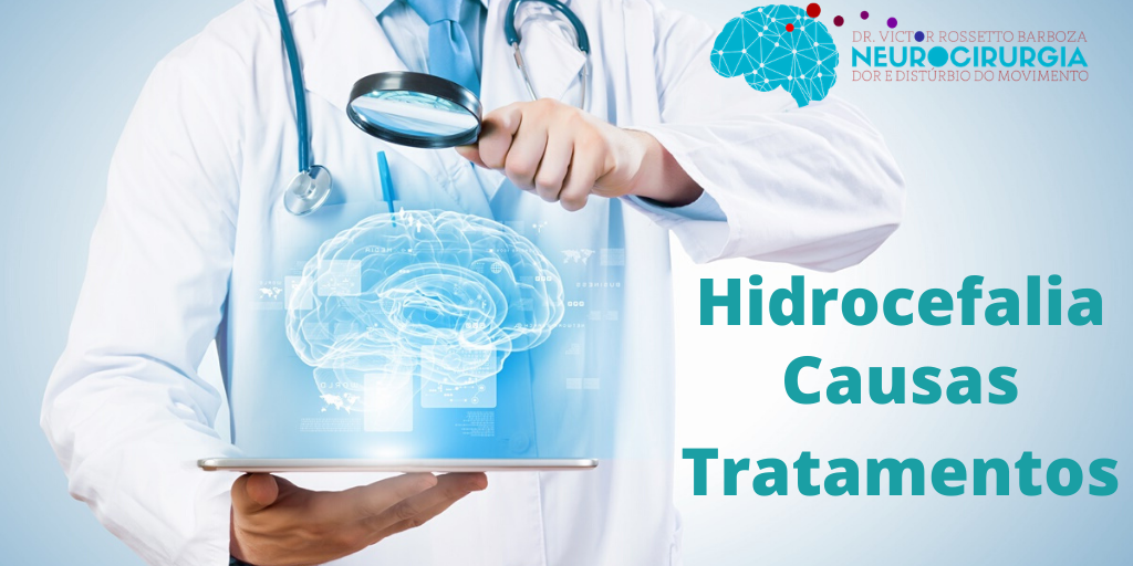 Diferentes Hidrocefalia Causas Tratamentos Veja Como Proceder 6322