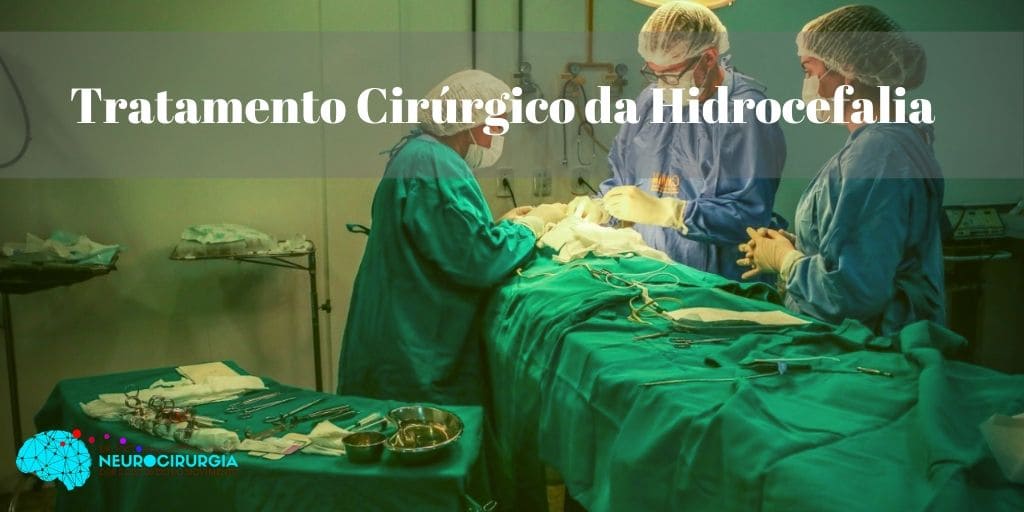 Conheça O Tratamento Cirúrgico Da Hidrocefalia Dr Victor Barboza 0205